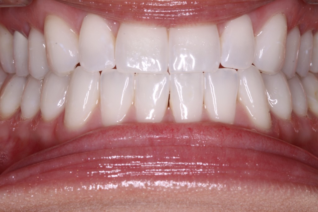 Gallery Dentist in Hopewell, NJ